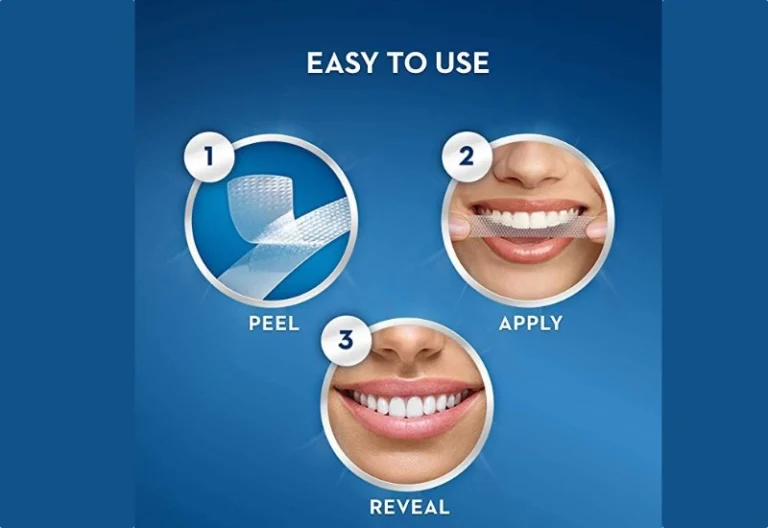 Hoe werkt thuis tanden bleken met strips veilig?